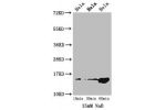 Western Blot<br />
Positive WB detected in:Hela cell acid extracts treated by NaB<br />
All lanes:HIST1H2AG antibody at 1.5