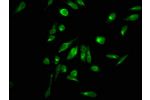 Immunofluorescence staining of hela with CSB-PA010389OA11me2HU,counter-stained with DAPI. The cells were fixed in 4% formaldehyde, permeabilized using 0.2% Triton X-100 and blocked in 10% normal Goat Serum. The cells were then incubated with the antibody 
