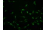 Immunofluorescence staining of hela with CSB-PA010389PA118crHU at 1:50,counter-stained with DAPI. The cells were fixed in 4% formaldehyde, permeabilized using 0.2% Triton X-100 and blocked in 10% normal Goat Serum. The cells were then incubated with the a