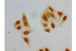 Immunocytochemistry analysis of Hela cells using CSB-PA010389PA36acHU at dilution of 1:100