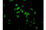 Immunofluorescent analysis of Hela cells(sodium butyrate,30 mM, 4h) using CSB-PA010389PA95hibHU at a dilution of 1:100 and Alexa Fluor 488-congugated AffiniPure Goat Anti-Rabbit IgG(H+L)
