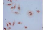 Immunocytochemistry analysis of Hela cells using CSB-PA010402NA05acHU at dilution of 1:100