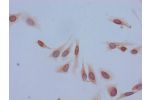 Immunocytochemistry analysis of Hela cells using CSB-PA010402PA05acHU at dilution of 1:100