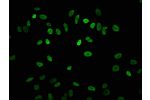 Immunofluorescence staining of Hela cells with CSB-PA010418OA04acHU,counter-stained with DAPI. The cells were fixed in 4% formaldehyde, permeabilized using 0.2% Triton X-100 and blocked in 10% normal Goat Serum. The cells were then incubated with the anti