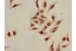 Immunocytochemistry analysis of Hela cells using CSB-PA010418OA09acHU at dilution of 1:100