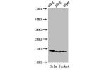 Western Blot<br />
Positive WB detected in:Hela cell acid extracts,Jurkat cell acid extracts<br />
All lanes:HIST1H3A antibody at 0.5