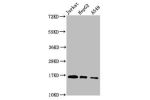 Western Blot<br />
Positive WB detected in:Jurkat whole cell lysate,HepG2 whole cell lysate,A549 whole cell lysate(treated by 30mM sodium butyrate for 4h)<br />
All lanes:HIST1H3A antibody at 1.18