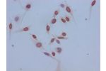 Immunocytochemistry analysis of Hela cells using CSB-PA010418OA14acHU at dilution of 1:100