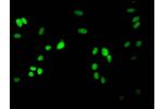 Immunofluorescent analysis of Hela cells using CSB-PA010418OA17me2HU at a dilution of 1:100 and Alexa Fluor 488-congugated AffiniPure Goat Anti-Rabbit IgG(H+L)