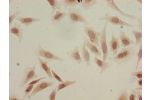 Immunocytochemistry analysis of Hela cells using CSB-PA010418OA18acHU at dilution of 1:100