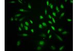 Immunofluorescence staining of Hela cells with CSB-PA010418OA18crHU at 1:25,counter-stained with DAPI. The cells were fixed in 4% formaldehyde, permeabilized using 0.2% Triton X-100 and blocked in 10% normal Goat Serum. The cells were then incubated with 