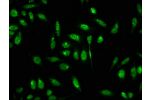 Immunofluorescence staining of Hela cells with CSB-PA010418OA18forHU,counter-stained with DAPI. The cells were fixed in 4% formaldehyde, permeabilized using 0.2% Triton X-100 and blocked in 10% normal Goat Serum. The cells were then incubated with the ant