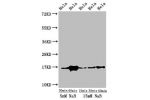 Western Blot<br />
Positive WB detected in:Hela cell acid extracts treated by NaB<br />
All lanes:HIST1H3A antibody at 1