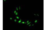 Immunofluorescent analysis of Hela cells treated with NaB using CSB-PA010418OA28acHU at a dilution of 1:100 and Alexa Fluor 488-congugated AffiniPure Goat Anti-Rabbit IgG(H+L)
