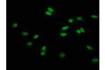 Immunofluorescence staining of Hela cells with CSB-PA010418OA56hibHU at 1:15,counter-stained with DAPI. The cells were fixed in 4% formaldehyde, permeabilized using 0.2% Triton X-100 and blocked in 10% normal Goat Serum. The cells were then incubated with