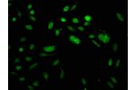 Immunofluorescence staining of Hela cells with CSB-PA010418OA64acHU,counter-stained with DAPI. The cells were fixed in 4% formaldehyde, permeabilized using 0.2% Triton X-100 and blocked in 10% normal Goat Serum. The cells were then incubated with the anti