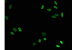Immunofluorescence staining of Hela cells with CSB-PA010418OA79acHU at 1:7.5,counter-stained with DAPI. The cells were fixed in 4% formaldehyde, permeabilized using 0.2% Triton X-100 and blocked in 10% normal Goat Serum. The cells were then incubated with