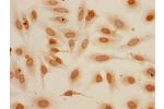 Immunocytochemistry analysis of Hela cells using CSB-PA010418PA04me2HU at dilution of 1:100