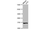 Western Blot<br />
Positive WB detected in:HEK293 cell acid extracts,A375 cell acid extracts<br />
All lanes:HIST1H3A antibody at 1