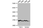 Western Blot<br />
Positive WB detected in:Hela cell acid extracts,Jurkat cell acid extracts<br />
All lanes:HIST1H3A antibody at 1