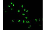 Immunofluorescent analysis of Hela cells treated by NaB using CSB-PA010418PA14acHU at a dilution of 1:100 and Alexa Fluor 488-congugated AffiniPure Goat Anti-Rabbit IgG(H+L)