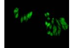 Immunofluorescent analysis of Hela cells using CSB-PA010418PA17me2HU at a dilution of 1:100 and Alexa Fluor 488-congugated AffiniPure Goat Anti-Rabbit IgG(H+L)