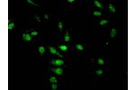 Immunofluorescent analysis of Hela cells treated with NaB using CSB-PA010429OA05acHU at a dilution of 1:100 and Alexa Fluor 488-congugated AffiniPure Goat Anti-Rabbit IgG(H+L)