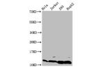 Western Blot<br />
Positive WB detected in:Hela whole cell lysate,Jurkat whole cell lysate,293 whole cell lysate,HepG2 whole cell lysate(treated with 30mM sodium butyrate for 4h)<br />
All lanes:HIST1H4A antibody at 0.14
