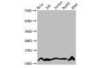 Western Blot<br />
Positive WB detected in:Hela whole cell lysate,293 whole cell lysate,Jurkat whole cell lysate,HepG2 whole cell lysate,K562 whole cell lysate(treated by 30mM sodium crotonylate for 4h)<br />
All lanes:HIST1H4A antibody at 2.2