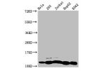 Western Blot<br />
Positive WB detected in:Hela whole cell lysate,293 whole cell lysate,Jurkat whole cell lysate,HepG2 whole cell lysate,K562 whole cell lysate(treated by 30mM sodium butyrate for 4h)<br />
All lanes:HIST1H4A antibody at 1.9