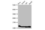 Western Blot<br />
Positive WB detected in:Hela whole cell lysate,Jurkat whole cell lysate,293 whole cell lysate,HepG2 whole cell lysate(treated by 30mM sodium crotonylate for 4h)<br />
All lanes:HIST1H4A antibody at 1.6