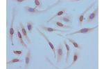 Immunocytochemistry analysis of Hela cells using CSB-PA010429OA12acHU at dilution of 1:100