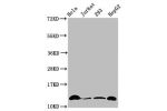 Western Blot<br />
Positive WB detected in:Hela whole cell lysate,Jurkat whole cell lysate,293 whole cell lysate,HepG2 whole cell lysate(treated by 30mM sodium crotonylate for 4h)<br />
All lanes:HIST1H4A antibody at 0.15