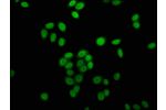Immunofluorescence staining of Hela cells (treated with 30mM sodium butyrate for 4h) with CSB-PA010429OA16butHU,counter-stained with DAPI. The cells were fixed in 4% formaldehyde, permeabilized using 0.2% Triton X-100 and blocked in 10% normal Goat Serum.