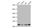Western Blot<br />
Positive WB detected in:Hela whole cell lysate,Jurkat whole cell lysate,293 whole cell lysate,HepG2 whole cell lysate(treated by 30mM sodium crotonylate for 4h)<br />
All lanes:HIST1H4A antibody at 1.5