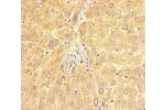 Immunohistochemistry of paraffin-embedded human liver tissue using CSB-PA01097A0Rb at dilution of 1:100