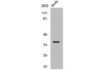 Western Blot analysis of HuvEc cells using Aldose Reductase Polyclonal Antibody