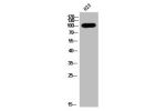Western Blot analysis of 823 cells using AR Polyclonal Antibody