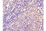 Immunohistochemistry of paraffin-embedded human lymph node tissue using CSB-PA011673HA01HU at dilution of 1:100