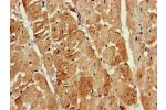 Immunohistochemistry of paraffin-embedded human heart tissue using CSB-PA012203LA01HU at dilution of 1:100