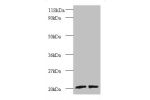 Western blot<br />
All lanes: ADP-ribosylation factor-like protein 2 antibody at 2ug/ml<br />
Lane 1 : EC109 whole cell lysate<br />
Lane 2 : 293T whole cell lysate<br />
Secondary<br />
Goat polyclonal to Rabbit IgG at 1/15000 dilution<br />
Predicted ba