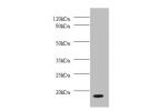 Western blot<br />
All lanes: Dynein light chain 1, cytoplasmic antibody at 2ug/ml+ EC109 whole cell lysate<br />
Secondary<br />
Goat polyclonal to Rabbit IgG at 1/15000 dilution<br />
Predicted band size: 9.8 kDa<br />
Observed band size: 9.8kDa<br />