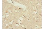 Immunohistochemistry of paraffin-embedded human brain tissue CSB-PA013060ESR2HU at dilution 1:100