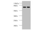 Western blot<br />
All lanes: Casein kinase I isoform epsilon antibody at 2ug/ml<br />
Lane 1 : EC109 whole cell lysate<br />
Lane 2 : 293T whole cell lysate<br />
Secondary<br />
Goat polyclonal to Rabbit IgG at 1/15000 dilution<br />
Predicted band size