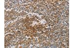 The image on the left is immunohistochemistry of paraffin-embedded Human tonsil tissue using CSB-PA014412(CKMT1A/CKMT1B Antibody) at dilution 1/80, on the right is treated with synthetic peptide. (Original magnification: 