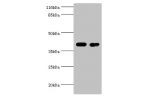Western blot<br />
All lanes:Creatine kinase B-type antibody at 2ug/ml<br />
Lane 1:Mouse brain tissue<br />
Lane 2:293T whole cell lysate<br />
Secondary<br />
Goat polyclonal to rabbit at 1/10000 dilution<br />
Predicted band size: 43kDa<br />
Observed 