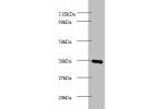 Western blot<br />
All lanes: Cytochrome c1, heme protein, mitochondrial Antibody at 2ug/ml+EC109 whole cell lysate<br />
Secondary<br />
Goat polyclonal to Rabbit IgG at 1/15000 dilution<br />
Predicted band size: 36kDa<br />
Observed band size: 36 kDa<b