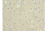 Immunohistochemistry of paraffin-embedded human brain tissue using CSB-PA015781ESR1HU at dilution 1:100