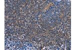The image on the left is immunohistochemistry of paraffin-embedded Human tonsil tissue using CSB-PA015892(AGFG1 Antibody) at dilution 1/60, on the right is treated with fusion protein. (Original magnification: 