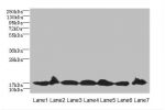 Western blot<br />
All lanes: G10 antibody at 5ug/ml<br />
Lane 1 : Jurkat whole cell lysate<br />
Lane 2 : Mouse liver tissue<br />
Lane 3 : Raji whole cell lysate<br />
Lane 4 : NIH/3T3 whole cell lysate<br />
Lane 5 : K562 whole cell lysate<br />
Lane 